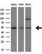 Nuclear Receptor Subfamily 1 Group H Member 3 antibody, LS-C790494, Lifespan Biosciences, Western Blot image 