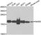 N(Alpha)-Acetyltransferase 50, NatE Catalytic Subunit antibody, A07316, Boster Biological Technology, Western Blot image 
