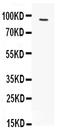 FPS antibody, PA1854, Boster Biological Technology, Western Blot image 