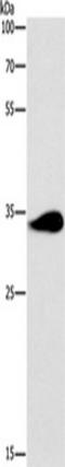 TNFAIP3 Interacting Protein 3 antibody, TA350727, Origene, Western Blot image 