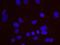 ATM Serine/Threonine Kinase antibody, NB100-271, Novus Biologicals, Proximity Ligation Assay image 