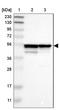 Proteasome 26S Subunit, Non-ATPase 4 antibody, NBP1-87800, Novus Biologicals, Western Blot image 