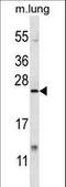 X-Box Binding Protein 1 antibody, LS-C160654, Lifespan Biosciences, Western Blot image 