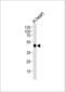 Creatine Kinase, Mitochondrial 2 antibody, 62-635, ProSci, Western Blot image 