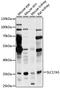 Solute Carrier Family 17 Member 5 antibody, LS-C750396, Lifespan Biosciences, Western Blot image 