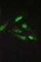 Sorcin antibody, A00222, Boster Biological Technology, Immunofluorescence image 