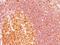 MALT1 Paracaspase antibody, NBP2-44349, Novus Biologicals, Immunohistochemistry paraffin image 