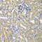 BAI1 Associated Protein 2 antibody, GTX33034, GeneTex, Immunohistochemistry paraffin image 