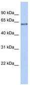 Propionyl-CoA Carboxylase Subunit Beta antibody, TA335153, Origene, Western Blot image 