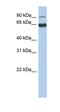 Protein Phosphatase 1 Regulatory Subunit 21 antibody, orb325823, Biorbyt, Western Blot image 