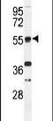 TOX High Mobility Group Box Family Member 3 antibody, PA5-24743, Invitrogen Antibodies, Western Blot image 