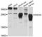 RAB39A, Member RAS Oncogene Family antibody, LS-C747388, Lifespan Biosciences, Western Blot image 