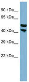 Proline Rich 5 Like antibody, TA329477, Origene, Western Blot image 