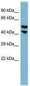 Proline Rich 5 Like antibody, TA329477, Origene, Western Blot image 