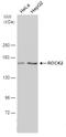 Rho Associated Coiled-Coil Containing Protein Kinase 2 antibody, NBP2-20199, Novus Biologicals, Western Blot image 