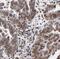 p53 antibody, FNab06084, FineTest, Immunohistochemistry frozen image 