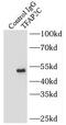 Transcription Factor AP-2 Gamma antibody, FNab08619, FineTest, Immunoprecipitation image 