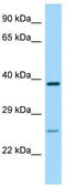 Purinergic Receptor P2Y14 antibody, TA338075, Origene, Western Blot image 