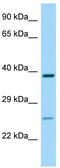 P2Y purinoceptor 14 antibody, TA338075, Origene, Western Blot image 