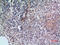 CD38 Molecule antibody, STJ96757, St John
