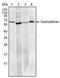 Ring Finger And CHY Zinc Finger Domain Containing 1 antibody, AM06384SU-N, Origene, Western Blot image 