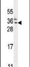 Heat Shock Protein Nuclear Import Factor Hikeshi antibody, PA5-24268, Invitrogen Antibodies, Western Blot image 