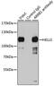 Helicase, Lymphoid Specific antibody, GTX54157, GeneTex, Immunoprecipitation image 