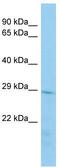 Transmembrane Protein 178A antibody, TA329555, Origene, Western Blot image 