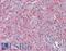 Protein Kinase C Beta antibody, LS-B9557, Lifespan Biosciences, Immunohistochemistry paraffin image 