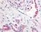 Platelet Derived Growth Factor Receptor Like antibody, NB110-55535, Novus Biologicals, Immunohistochemistry paraffin image 