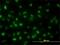 DNA Topoisomerase II Alpha antibody, H00007153-M01, Novus Biologicals, Immunocytochemistry image 