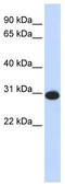 Calcium Modulating Ligand antibody, TA346562, Origene, Western Blot image 