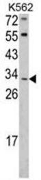 Integral Membrane Protein 2A antibody, GTX81726, GeneTex, Western Blot image 