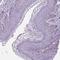 Proopiomelanocortin antibody, NBP2-57719, Novus Biologicals, Immunohistochemistry frozen image 