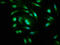 Proteasome 26S Subunit, Non-ATPase 10 antibody, LS-C370167, Lifespan Biosciences, Immunofluorescence image 