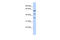 PHD Finger Protein 23 antibody, 26-590, ProSci, Western Blot image 