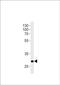 Homeobox protein Hox-C9a antibody, PA5-72628, Invitrogen Antibodies, Western Blot image 