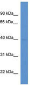 Mitochondrial carrier homolog 1 antibody, TA341932, Origene, Western Blot image 