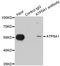 ATP Synthase F1 Subunit Alpha antibody, LS-B13890, Lifespan Biosciences, Immunoprecipitation image 