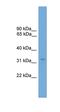 Transcription Elongation Factor A2 antibody, orb326249, Biorbyt, Western Blot image 