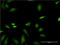 Farnesyltransferase, CAAX Box, Beta antibody, LS-C197239, Lifespan Biosciences, Immunofluorescence image 