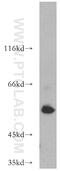 Angio-associated migratory cell protein antibody, 21220-1-AP, Proteintech Group, Western Blot image 