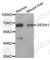 Sestrin 1 antibody, A3417, ABclonal Technology, Western Blot image 