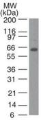 Telomeric Repeat Binding Factor 2 antibody, GTX13579, GeneTex, Western Blot image 