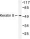 Keratin 8 antibody, LS-C176102, Lifespan Biosciences, Western Blot image 