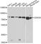 DEAD-Box Helicase 3 X-Linked antibody, A5637, ABclonal Technology, Western Blot image 