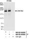 Zinc Finger MYM-Type Containing 4 antibody, NB100-95000, Novus Biologicals, Western Blot image 