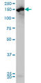 Carbamoyl-Phosphate Synthase 1 antibody, LS-B5392, Lifespan Biosciences, Western Blot image 