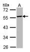 Ornithine Decarboxylase 1 antibody, LS-B10752, Lifespan Biosciences, Western Blot image 