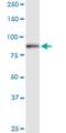 Doublecortin Like Kinase 1 antibody, H00009201-M01, Novus Biologicals, Western Blot image 